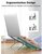 UGREEN - Laptop állvány, összecsukható, állítható, szürke - 40289